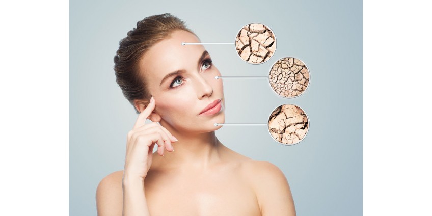 Sequedad de la piel en otoño e invierno: soluciones eficaces para su protección y recuperación