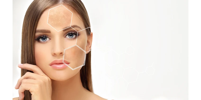 Mesoterapia: con o sin agujas. Comparación de eficacia y comodidad