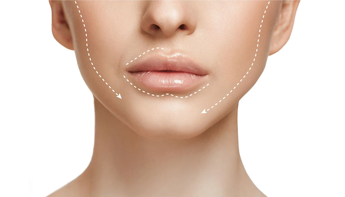 la battaglia dei giganti: confronto tra facial radiofrecuencia e HIFU