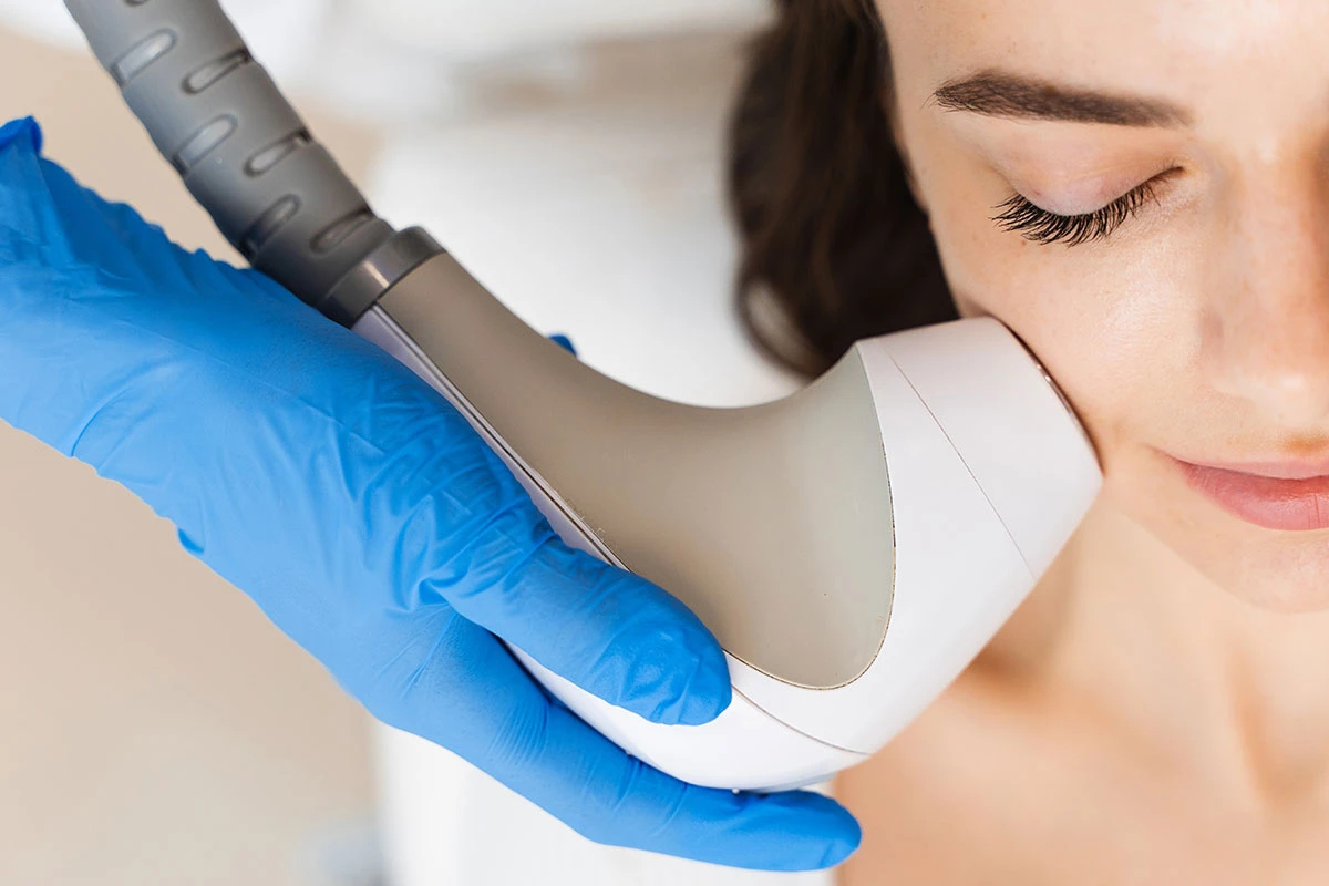 la scelta è vostra: come scegliere tra facial radiofrecuencia e HIFU