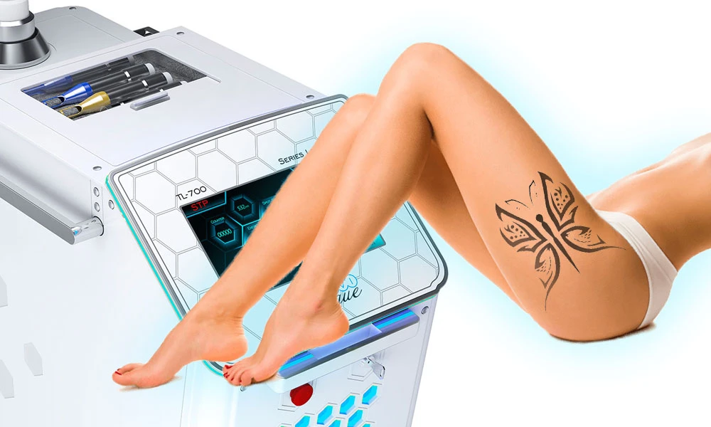 Eliminación de tatuajes con láser de picosegundos de neodimio en preguntas y respuestas