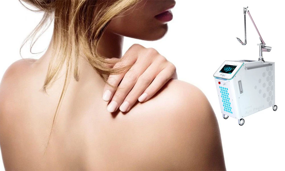 Cómo cuidar tu piel después de la eliminación de tatuajes con láser