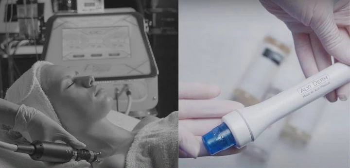 Procedimientos con aparatos para pieles sensibles y propensas a alergias