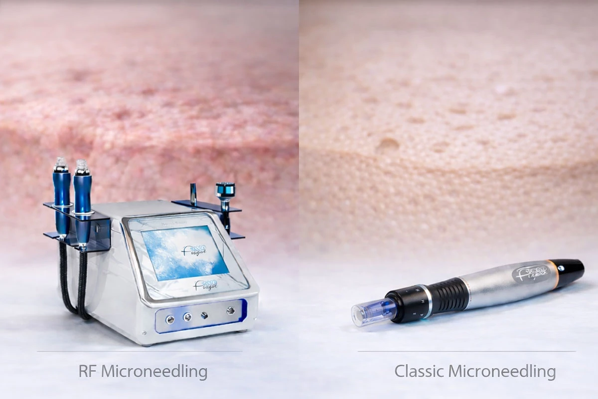 RF con microagujas o microneedling clásico