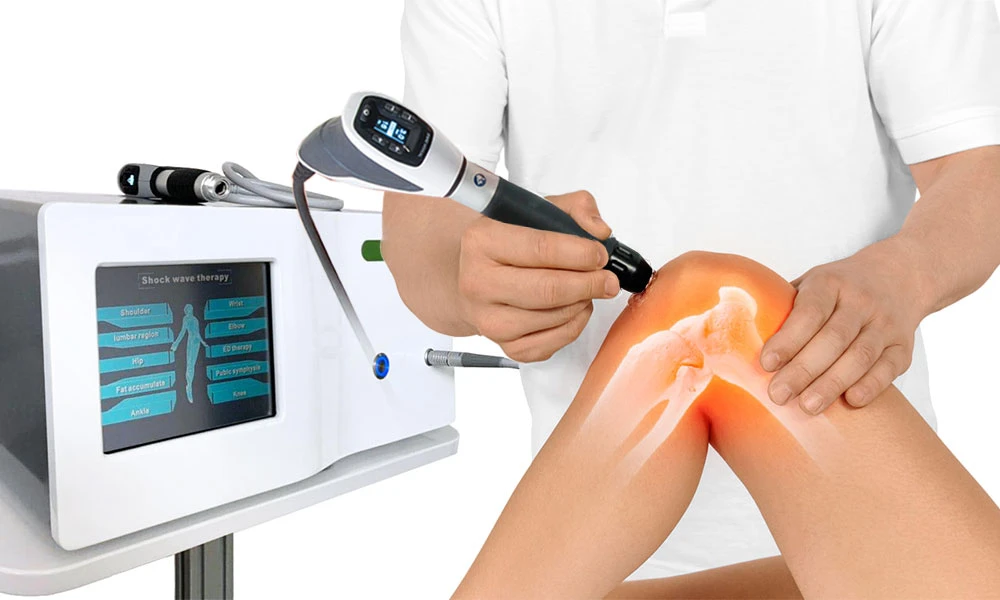 Terapia por Ondas de Choque: Eficacia y Beneficios